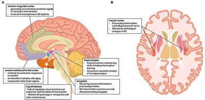 Brain Neural Underpinnings of Interoception and Decision-Making in Alzheimer's Disease: A Narrative Review